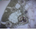 Příčný řez stonkem sítiny (Juncus sp.) názorně ukazuje aerenchym. Je obarvený floroglucinolem – buňky obsahující  lignin se zbarví růžově. Zvětšení 100krát. Foto P. Šíma