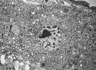 Symbiotické bakterie Buchnera aphidicola vyplňující cytoplazmu okolo jádra hostitelské buňky. Hostitelem je mšice kyjatka hrachová (Acyrthosiphon pisum). Snímek z transmisní elektronové mikroskopie (TEM). Foto J. White a N. Moran. https://commons.wikimedia.org/wiki/, převzato v souladu s podmínkami využití.