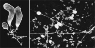 Měchýřky mikroskopické houby Geosiphon pyriforme obsahují symbiotické sinice rodu Nostoc. Foto A. Schüßler. Všechny snímky převzaty v souladu s podmínkami využití, přesnou citaci zdroje uvádíme v použité literatuře  na webové stránce Živy.