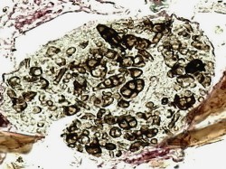Mezenteron pancířníka druhu  Belba pseudocorynopus se sporami  houby Alternaria sp.  Barvení Massonův trichrom. Foto Jaroslav Smrž