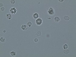 Hemocyty zavíječe voskového – v mikroskopu můžeme pozorovat různé typy volných buněk, zejména granulocyty (výrazná zrnka uvnitř buňky)  a plasmatocyty (mění tvar – vytvářejí panožky a mohou přilnout k povrchu). Foto P. Hyršl