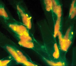 Buňky v kolonii zlativky rodu Dinobryon s pohlcenými fluorescenčně značenými bakteriemi, což jsou žluté  fluoreskující malé buňky, které se přidávají v malé proporci do přírodního  bakterioplanktonu jako „stopovač“  rychlosti příjmu bakteriálních buněk. Protože jde o mixotrofní prvoky, tedy mikroorganismy kombinující příjem  partikulované potravy – bakterie – a současně fotosyntézu podobně jako řasy,  při použití vlnové délky 530 nm v epifluo­rescenčním mikroskopu v pozadí červeně prosvítají i chloroplasty uložené v cytoplazmě buněk těchto prvoků. Foto K. Šimek