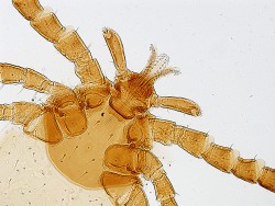 Nastavení Köhlerova osvětlení – co se ukazuje v zorném poli. Jako modelový preparát je použita larva klíštěte obecného (Ixodes ricinus) – zde po nastavení ideálního Köhlerova osvětlení. Foto J. Bulantová