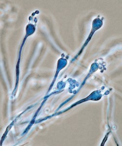 Fungikolní houba Cryptococcus depauperatus (CCF 2746) je homothalická – na myceliu tvoří jednotlivé bazidie se čtyřmi stopkami, na nichž vyrůstají v řetízcích bazidiospory. Zvětšení 1 000×. Foto A. Kubátová