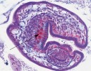 Histologický řez formující se hlavičkou – protoskolexem –  budoucí tasemnice měchožila větveného (Echinoccocus multilocularis) s již předpřipravenými čtyřmi svalnatými přísavkami a vchlípeným  rostelem s háčky (šipka).  Foto J. Bulantová 