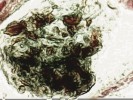 Zástupce pancířníků Achipteria  coleoptrata – v mezenteronu převažují fragmenty mechu z koruny stromu. Foto Jaroslav Smrž