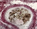Zástupce pancířníků Achipteria  coleoptrata – v rektu druhého jedince žijícího v půdě u kořenů stromu jsou spory a fragmenty mycelia hub z půdy  u paty stromu. Massonův trichrom.Foto Jaroslav Smrž