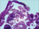 Bakterie Bacillus sp. v bakteriálním tělese okolo střeva u pancířníka  D. onustus. Barvení Pianese. Foto Jaroslav Smrž