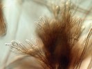 Konidie druhu Phialocephala scopiformis vznikají na charakteristických přeslenech konidiogenních buněk.  Tento zástupce řádu voskovičkotvaré (Helotiales) se často vyskytuje jako  endofyt jehlic smrku v Severní Americe, ale můžeme ho najít i v jehlicích smrku  ztepilého v Evropě. Foto Z. Haňáčková