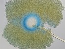 Konidiofor Aspergillus westerdijkiae s typickým kulovitým měchýřkem a masou konidií. Foto A. Kubátová
