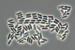 Konidie Metarhizium anisopliae (masenkotvaré – Hypocreales, vřeckovýtrusné – Ascomycota). Foto A. Kubátová