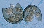 Plodnice Ascosphaera apis s mnohasporo­vými synasky (vřecka s množstvím spor) v optickém mikroskopu. Foto A. Kubátová