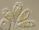 Několik jedinců plísenky (Epistylis sp.) z mohutné kolonie přichycené rozvětvenými stopkami na ulitu plovatky bahenní (Lymnaea stagnalis). Každá z nálevek má věnec brv, jimiž prvoci filtrují potravu z okolí, např. zelené řasy, které dodávají potravním vakuolám nálevníka zelené zbarvení. Nativní preparát, Nomarského kontrast, zvětšeno 400×. Foto J. Bulantová
