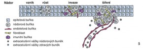 Extracelulární váčky u nádorového bujení se účastní všech fází vývoje nádoru. Při jeho vzniku okolní zdravé buňky sekretují váčky obsahující miRNA, které potlačují růst nádoru. Nádorové buňky mohou této inhibici růstu uniknout a dále se množit. Váčky pocházející z nádorových buněk mohou také do okolních buněk šířit poškozené geny podporující množení buněk. Váčky nádorových buněk působí na fibroblasty, které sekrecí cytokinů podporují další množení nádorových buněk a zároveň odbouráváním okolní mezibuněčné hmoty vytvářejí  prostor pro růst nádoru. Pokud je okolní prostředí hypoxické, váčky nádorových buněk a fibroblastů podporují dělení buněk endotelu (cévní výstelky) a růst nových cév. To umožňuje další šíření nádoru a tvorbu metastáz. Orig. H. Kupcová Skalníková