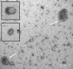 Exozomy produkované buňkami nádoru prsu během kultivace in vitro. V transmisním elektronovém mikroskopu mají typický miskovitý tvar (viz šipky a vložené výřezy). Zvětšení 100 000×. Foto H. Kupcová Skalníková