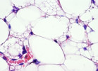 Histologický snímek podkožní tukové tkáně myši chované v chladu. Na snímku se objevují menší tukové kapénky – dochází k hnědnutí. Fialově hematoxylin – jádra; růžově eozin – cytoplazma, hlavně erytrocyty; neobarvené – tukové kapénky. Navíc je zde vidět několik cév s červenými krvinkami. Foto K. Bardová