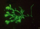 Průkaz hyf mukormycetů ze vzorku plicní tkáně ve fluorescenčním mikroskopu po obarvení blankoforem. Foto P. Lysková