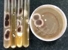 Kultivační průkaz kropidláku Aspergillus niger a kvasinek ze sputa u pacientky  s chronickou plicní aspergilózou (Sabouraudův dextrózový agar, po 48 hodinách). Foto P. Lysková
