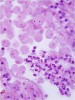 Parazitické améby druhu Enta­moeba histolytica na histologickém  preparátu zhotoveném z biopsie stěny tlustého střeva při onemocnění zvaném amébová kolitida. Preparát je obarven metodou hematoxylin a eozin. Foto E. Nohýnková