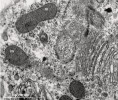 Příklady vodík produkujících mitochondrií (m, hydrogenosomů) obligátně anaerobních eukaryot, jak jsou vidět v transmisním elektronovém mikroskopu. Mitochondrie mořské trichomonády (pimpavičky) Alexandriella bishopae (Metamo nada: Parabasalia) kristy ztratily. Na obrázku jsou vidět i některé jiné struktury, např. Golgiho aparát. Foto A. Kubánková