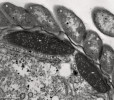 Příklady vodík produkujících mitochondrií (m, hydrogenosomů) obligátně anaerobních eukaryot, jak jsou vidět v transmisním elektronovém mikroskopu. Mitochondrie mořského volně žijícího nálevníka Metacyclidium pallium (Sar: Alveolata: Ciliophora) z třídy Oligohymenophorea mají dosud zachovány kristy. Na obrázku jsou vidět i některé jiné struktury, např. bakteriální ektosymbionti rodu Metacyclidium (b). Foto K. Koštířová