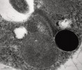Příklady vodík produkujících mitochondrií (m, hydrogenosomů) obligátně anaerobních eukaryot, jak jsou vidět v transmisním elektronovém mikroskopu. Mitochondrie Pseudoharpagon tertius (Discoba: Heterolobosea) kristy ztratily.  Foto I. Čepička