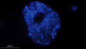  Autofluorescence metanogenních  symbiontů v cytoplazmě sladkovodního  anaerobního nálevníka Urostomides  denarius z řádu Metopida po osvícení  ultrafialovým zářením. „Díra“ uprostřed  buňky je makronukleus, ve kterém sym bionti nejsou. Foto D. Méndez-Sánchez 