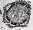 Příčný řez buňkou mořského nálevníka Metacyclidium pallium z podtřídy  Scuticociliatia s přisedlými symbionty,  pravděpodobně síran redukujícími   bakteriemi (S). Kromě nich jsou vidět  podpovrchové hydrogenosomy (H)   a kortikální alveoly (ploché podpovrcho vé váčky, K). Snímek z transmisního  elektronového mikroskopu.   Foto K. Koštířová 