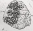 Buňka mořské měňavky druhu   Anaeramoeba flamelloides s agregátem  symbiontů (S) a hydrogenosomů (H).   Je vidět také jádro (J) a potravní vakuo ly  (P). Snímek z transmisního elektronové ho mikroskopu. Foto I. Čepička