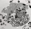  Buňka mořské měňavky nepopsaného druhu rodu Anaeramoeba s agregátem symbiontů (S) a hydrogenosomů (H).  Zřetelné je i jádro (J). Snímek z transmisního elektronového mikroskopu.  Foto M. Pavlátová 