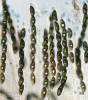 Vřecka s askosporami dřevnatky dlouhonohé (Xylaria longipes) s modře zbarveným askoapikálním aparátem. Foto O. Koukol