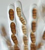 Vrchol vřecka skulinatníku morušového (Hysterographium mori). Vícebuněčné askospory a silná stěna vřecka jsou charakteristické pro funkčně bitunikátní typ vřecka (blíže v textu). Foto O. Koukol