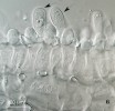 Vřecka kadeřavky broskvoňové (Taphrina deformans), nezralá (viz šipky) na povrchu listu broskvoně