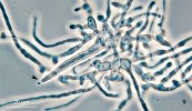 Mycelium druhu Dipodascopsis  uninucleata s jedním zralým vřeckem. Spory jsou vytlačovány skrz zašpičatělý vrcholek (šipka). Foto O. Koukol