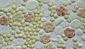 Vřecka s askosporami druhu Aspergillus pseudoglaucus. Foto A. Kubátová