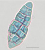 Rozmnožovací struktury kloubnatky smrkové (Gemmamyces piceae). Askospora. Měřítko 10 μm. Foto K. Černý