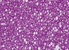 Histologie jater halančíka tyrkysového (Nothobranchius furzeri). Okrouhlé vakuoly lipidové vakuolizace hepatocytů. Foto I. Dyková a J. Žák 