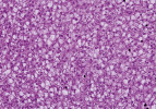 Histologie jater halančíka tyrkysového (Nothobranchius furzeri). Glykogenní vakuolizace hepatocytů s nepravidelnými tvary vakuol. Rozdílné formy ukládání zásobních látek v játrech souvisejí se složením potravy. Foto I. Dyková a J. Žák 