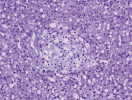 Histologie jater halančíka tyrkysového (Nothobranchius furzeri). Léze v játrech dříve považovaná za nádorové bujení. Foto I. Dyková a J. Žák 