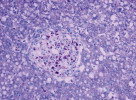 Histologie jater halančíka tyrkysového (Nothobranchius furzeri).  Potvrzení, že nejde o nádor, ale o infekci. Semiseriální řez na stejném místě obarvený specifickým barvivem prokazujícím přítomnost bakterií (červeno-fialové) jakožto původce léze. Foto I. Dyková a J. Žák (obr. 3–6)