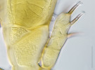 Anteridia (samčí  pohlavní orgány)  na bázi plodnice  vřeckovýtrusné houby labulbénie  z druhového komplexu Hesperomyces  virescens (Laboulbeniales).  Válcovité konidie  vylučované z trubicovitě zakončených anteridií se nazývají spermacie a slouží k pohlavnímu procesu. Měřítko 20 μm. Foto O. Koukol