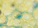 Octosporella perforata – hyfy  s jednoduchým apresoriem na lístku (fyloidu) podhořanky plocholisté  (Porella platyphylla). Foto L. Janošík