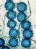 Vřecka s obarvenými výtrusy kulosporky Lamprospora maireana s charakteristickou ornamentikou tvořenou výraznými bradavičkami s početnými dutinami. Tato houba čerpá živiny z rhizoidů (příchytných vláken) hostitelského mechu – úpolničky střídavolisté (Archidium alternifolium). Foto L. Janošík