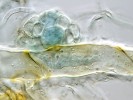 Detail infekční struktury zatím nepopsaného druhu z okruhu kulosporky Lamprospora feurichiana na příchytném vlákně (rhizoidu) velešky Starkeovy (Kiaeria starkei). Na povrchu rhizoidu je vidět modře obarvené, hyfovým pláštěm  obalené apresorium sloužící k přichycení houby k hostiteli. Vychází z něj infekční kanál prorážející dovnitř buňky hostitele, kde prochází ve větvené haustorium. Foto L. Janošík