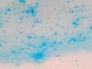 Mikroskopický snímek biofilmu  Staphylococcus epidermidis, barveno alciánovou modří, která se selektivně váže na polysacharidy. Stafylokoky  rostoucí ve formě biofilmu produkují velké množství extracelulárních poly­sacharidů – na obr. dobře patrná  polysacharidová biofilmová vrstva  obklopující shluky stafylokokových buněk. Foto V. Holá