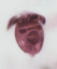 Nálevník Rimostrombidium sp. (více na dalším snímku). Podle: K. Šimek a kol. (2019)