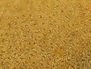 Masa spor mikrosporidie rodu Amblyospora (velikost 12 μm ) uvolněných z tkání buchanky obecné (Cyclops strenuus). Foto V. Vávra