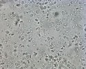 Spory Nosema ceranae z obsahu žaludku včely medonosné (Apis mellifera). Velikost spor asi 4–5 μm. Foto M. Kamler