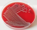 Enterobakterie Yersinia enterocolitica, blízce příbuzná původci moru  Y. pestis. Bakteriální kolonie na krevním agaru po 20 hodinách růstu. Foto  M. Marejková (Státní zdravotní ústav, Centrum epidemiologie a mikrobiologie)