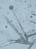 Sporangiofor se sporangiem druhu Mortierella humilis. Foto A. Nováková